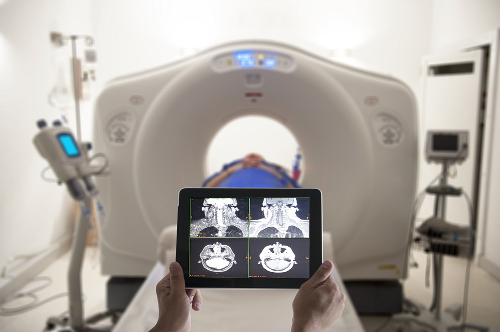PET-CT Scan